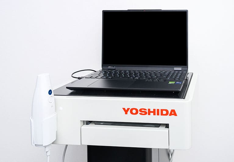 口腔内スキャナー