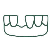 補綴治療<br>入れ歯