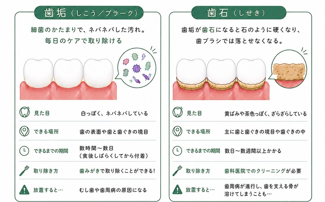 歯科医院で行うクリーニングとは・・・